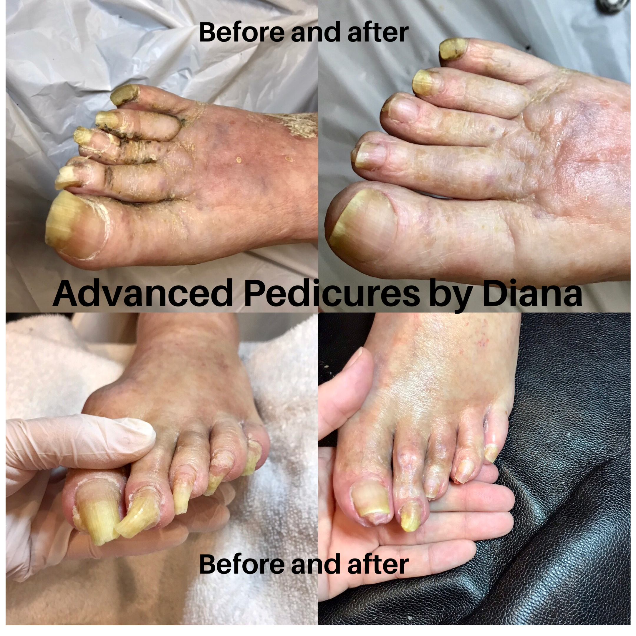 Seniors Mobile Foot and Nail Care by Diana's Divine Escape, Mobile Spa & Salon and Spa at